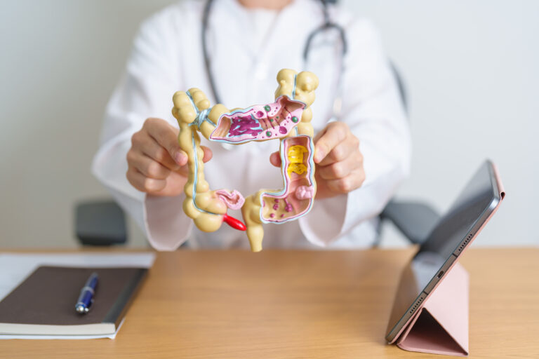 Cancerul de colon, cel mai mortal la persoanele sub 50 de ani