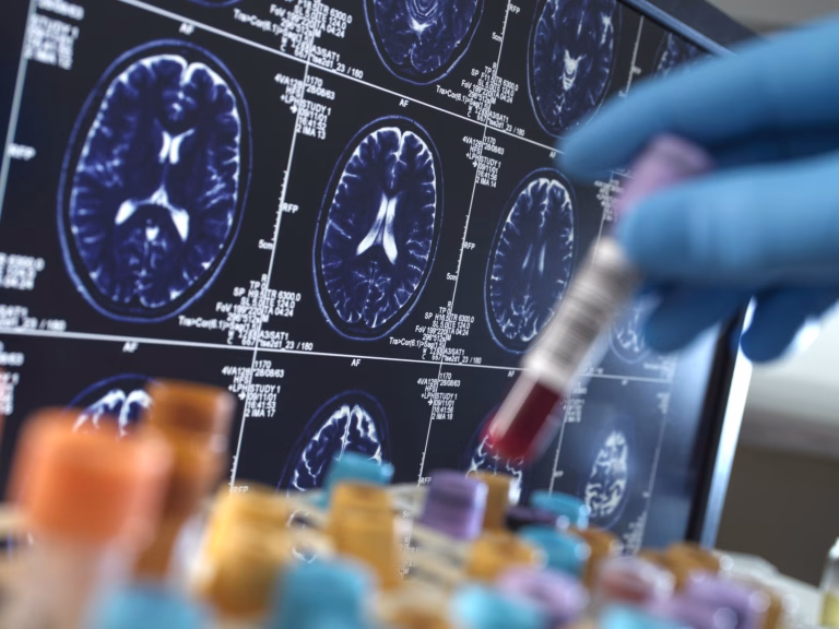 Novartis suspendă opt studii clinice CAR-T după trei decese